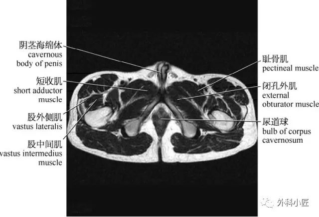 影像PPT - 46组对比图带你完全掌握腹部影像解剖-86 影像PPT - 46组对比图带你完全掌握腹部影像解剖-86