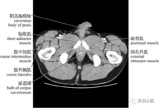 影像PPT - 46组对比图带你完全掌握腹部影像解剖-87 影像PPT - 46组对比图带你完全掌握腹部影像解剖-87