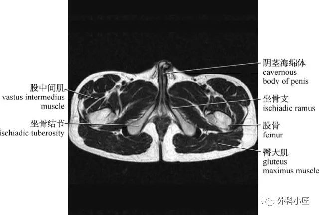 影像PPT - 46组对比图带你完全掌握腹部影像解剖-89 影像PPT - 46组对比图带你完全掌握腹部影像解剖-89