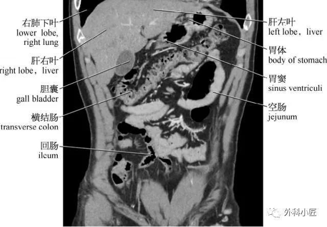 影像PPT - 46组对比图带你完全掌握腹部影像解剖-99 影像PPT - 46组对比图带你完全掌握腹部影像解剖-99