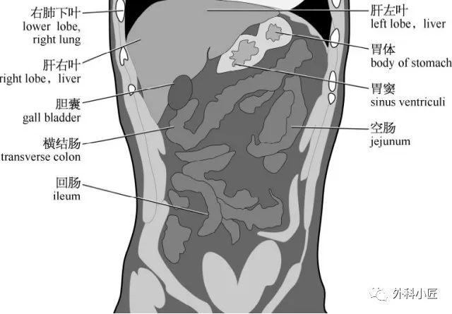 影像PPT - 46组对比图带你完全掌握腹部影像解剖-100 影像PPT - 46组对比图带你完全掌握腹部影像解剖-100
