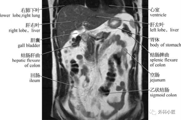 影像PPT - 46组对比图带你完全掌握腹部影像解剖-110 影像PPT - 46组对比图带你完全掌握腹部影像解剖-110