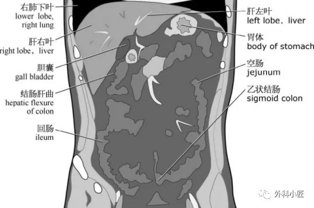 影像PPT - 46组对比图带你完全掌握腹部影像解剖-112 影像PPT - 46组对比图带你完全掌握腹部影像解剖-112