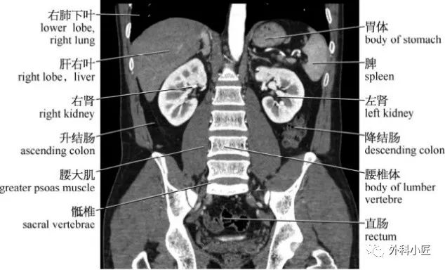 影像PPT - 46组对比图带你完全掌握腹部影像解剖-129 影像PPT - 46组对比图带你完全掌握腹部影像解剖-129