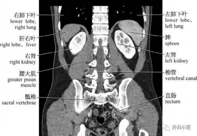 影像PPT - 46组对比图带你完全掌握腹部影像解剖-135 影像PPT - 46组对比图带你完全掌握腹部影像解剖-135