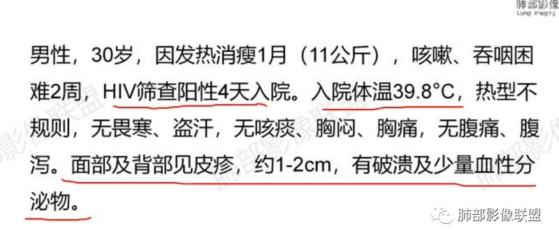 影像PPT - 【病例】马尔尼菲篮状菌感染1例CT影像-13 影像PPT - 【病例】马尔尼菲篮状菌感染1例CT影像-13