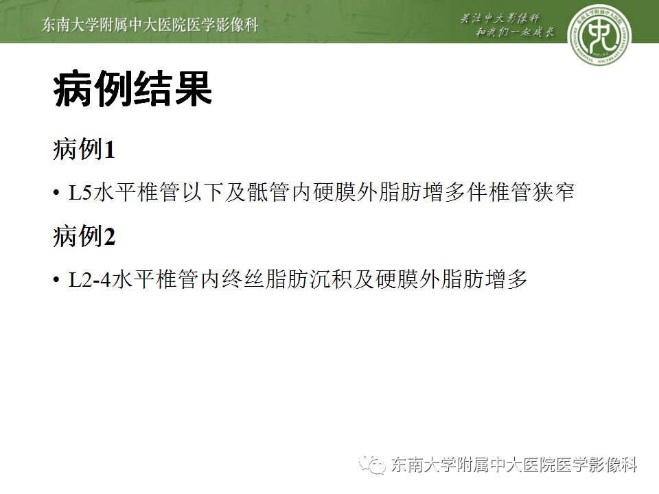 影像PPT - 【PPT】椎管内硬膜外脂肪增多症与终丝脂肪堆积-3