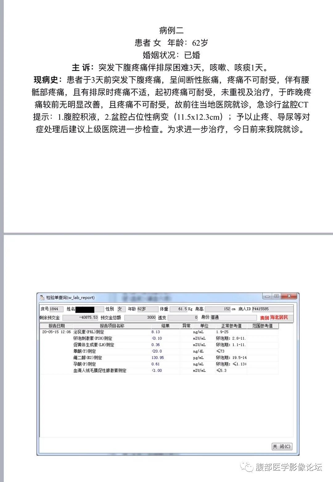 影像PPT - 【病例】卵巢成年型颗粒细胞瘤1例MR-1