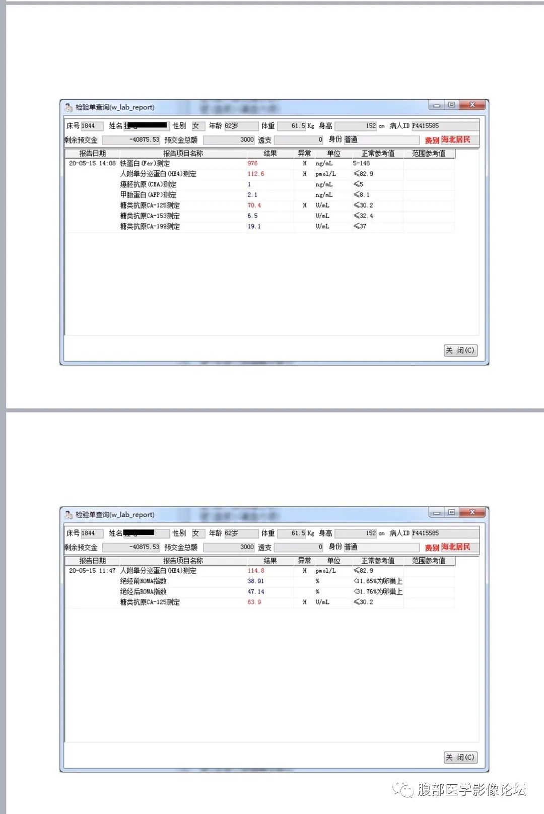影像PPT - 【病例】卵巢成年型颗粒细胞瘤1例MR-2