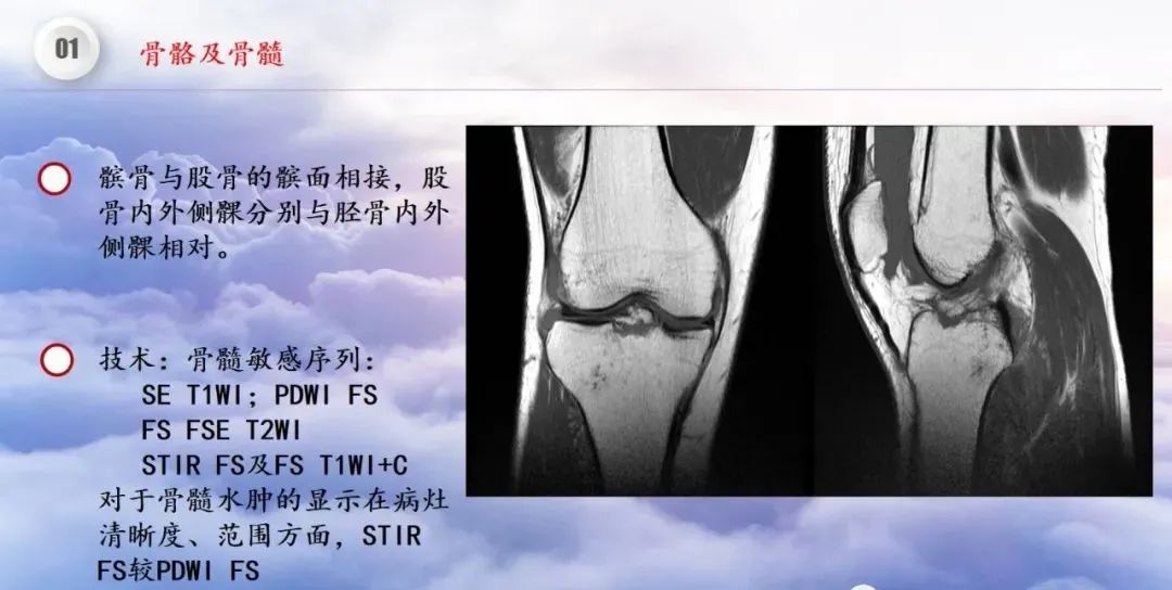 影像PPT - 【PPT】膝关节正常解剖及MR信号特点-5