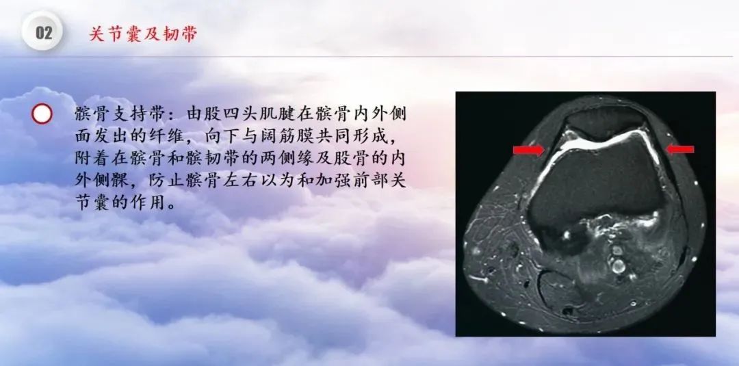 影像PPT - 【PPT】膝关节正常解剖及MR信号特点-17