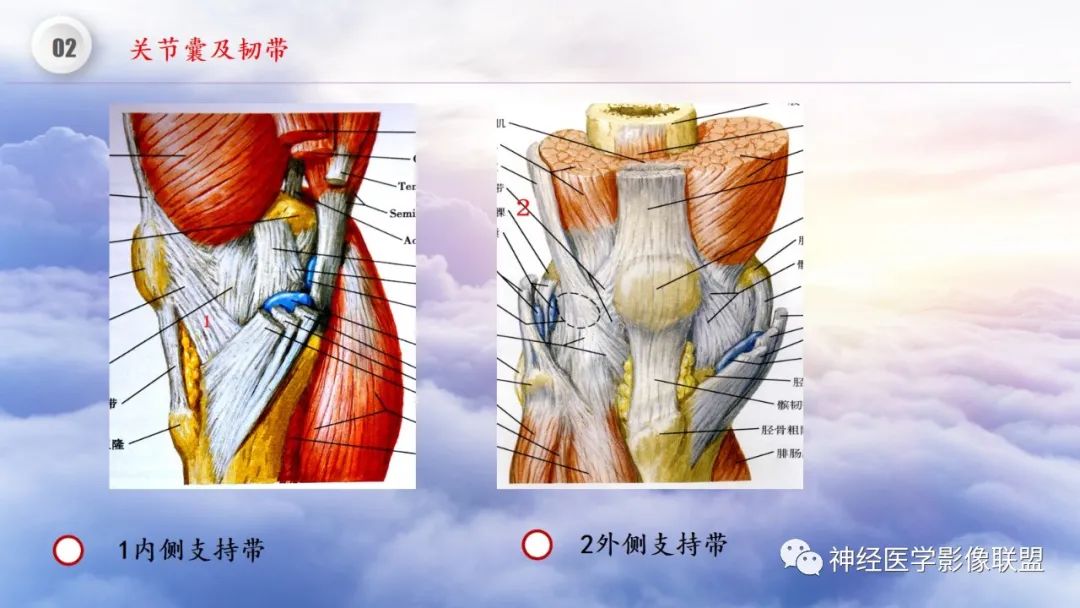 影像PPT - 【PPT】膝关节正常解剖及MR信号特点-16