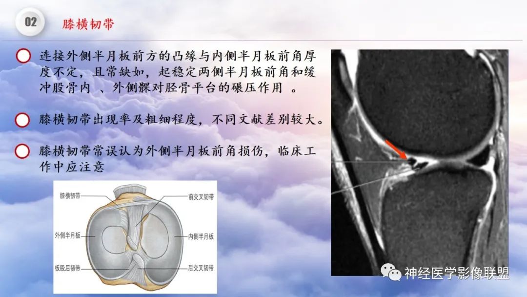 影像PPT - 【PPT】膝关节正常解剖及MR信号特点-23