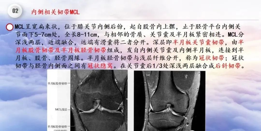 影像PPT - 【PPT】膝关节正常解剖及MR信号特点-28