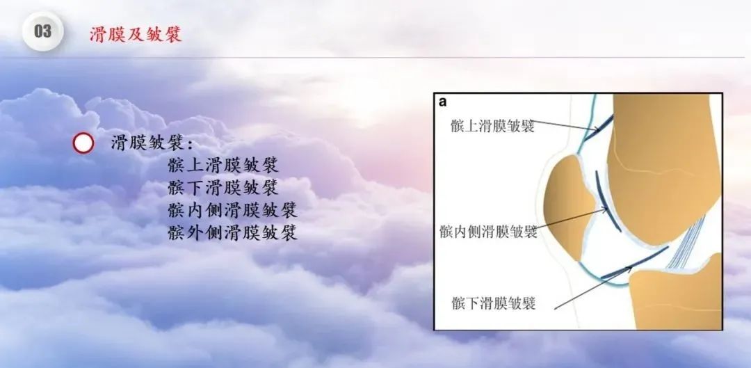 影像PPT - 【PPT】膝关节正常解剖及MR信号特点-35