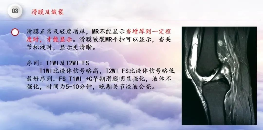 影像PPT - 【PPT】膝关节正常解剖及MR信号特点-37