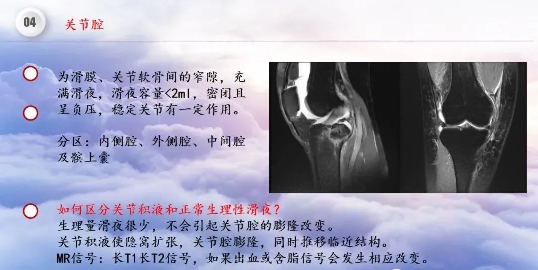 影像PPT - 【PPT】膝关节正常解剖及MR信号特点-40