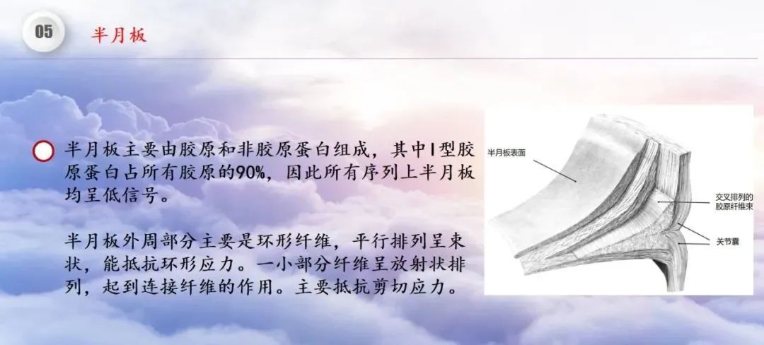 影像PPT - 【PPT】膝关节正常解剖及MR信号特点-42
