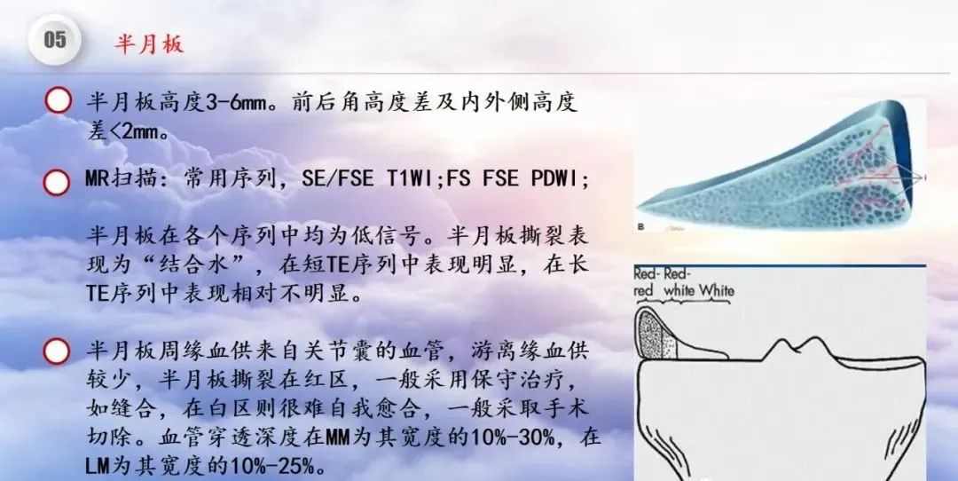 影像PPT - 【PPT】膝关节正常解剖及MR信号特点-43