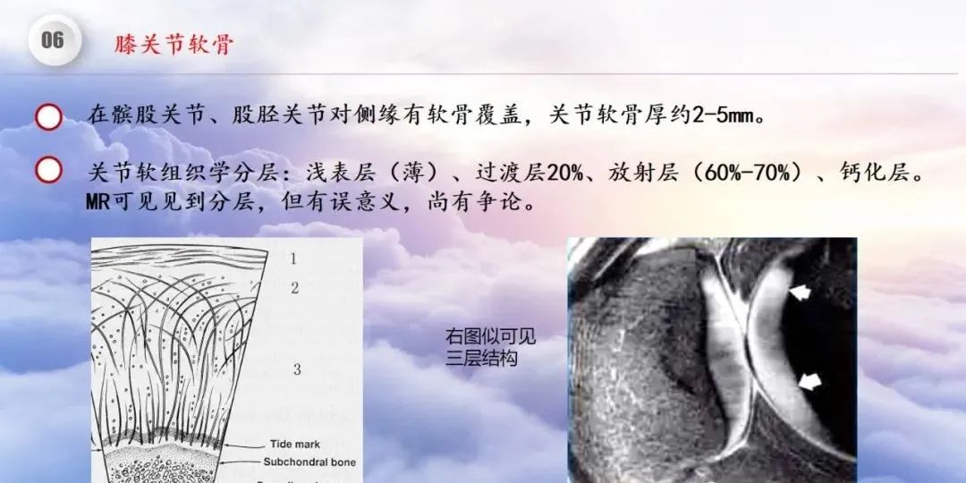 影像PPT - 【PPT】膝关节正常解剖及MR信号特点-48