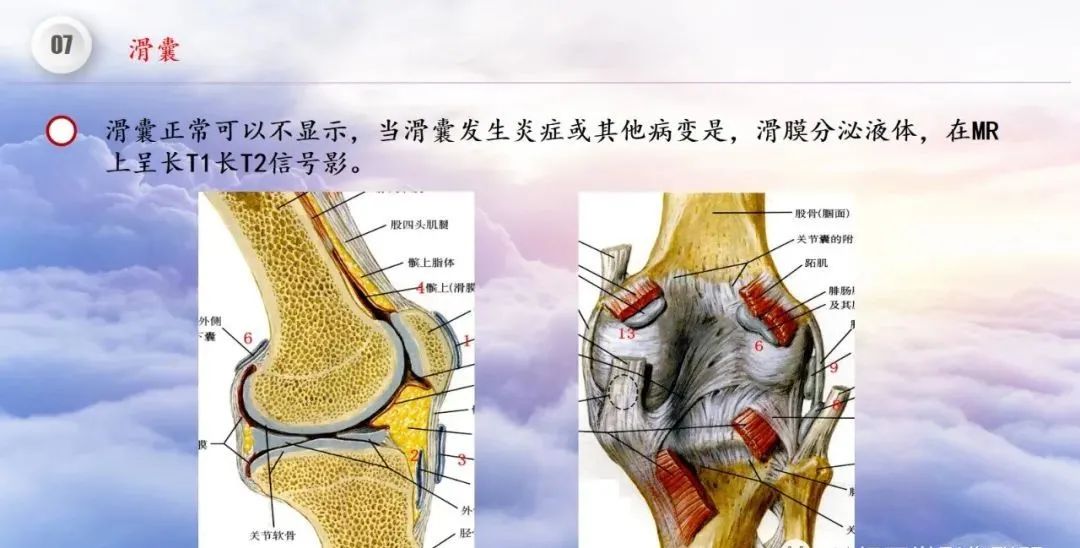影像PPT - 【PPT】膝关节正常解剖及MR信号特点-53