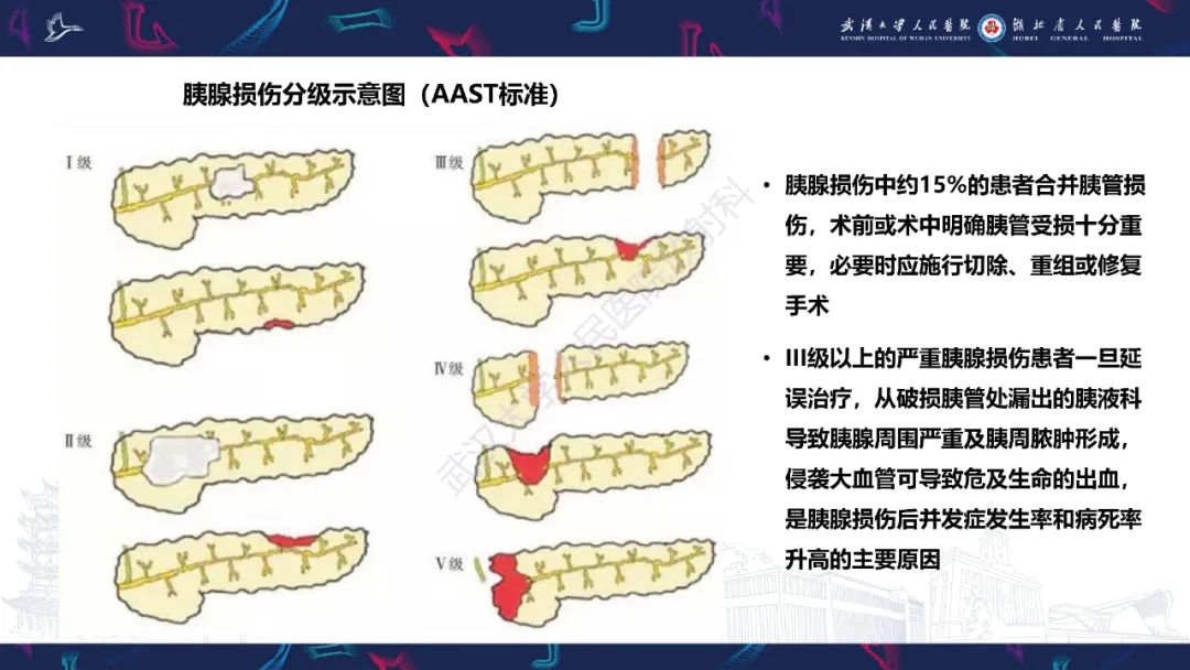 影像PPT - 【PPT】胰腺损伤影像诊断-9