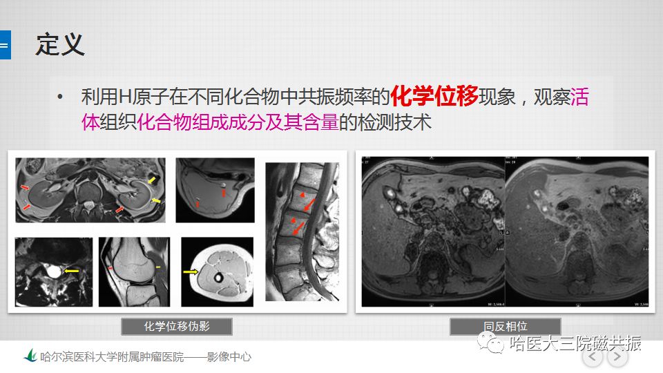 影像PPT - 【PPT】磁共振波谱（MRS）的那些事-5
