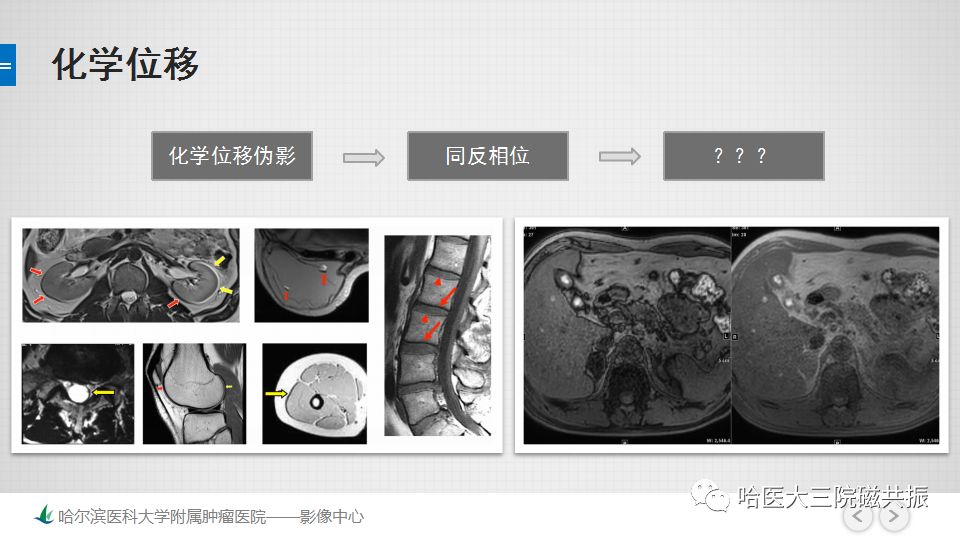 影像PPT - 【PPT】磁共振波谱（MRS）的那些事-8