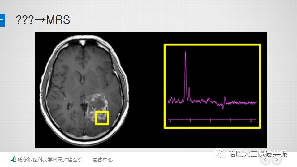 影像PPT - 【PPT】磁共振波谱（MRS）的那些事-9