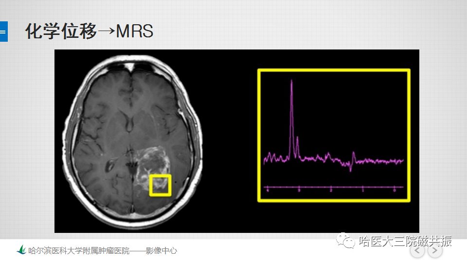 影像PPT - 【PPT】磁共振波谱（MRS）的那些事-13