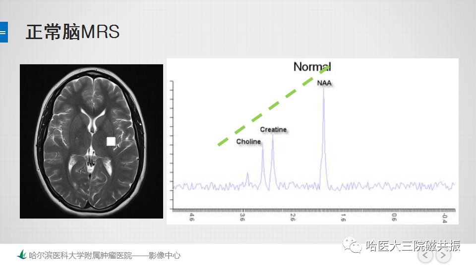 影像PPT - 【PPT】磁共振波谱（MRS）的那些事-15