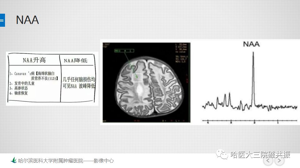 影像PPT - 【PPT】磁共振波谱（MRS）的那些事-23
