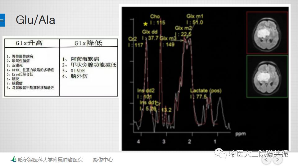 影像PPT - 【PPT】磁共振波谱（MRS）的那些事-24