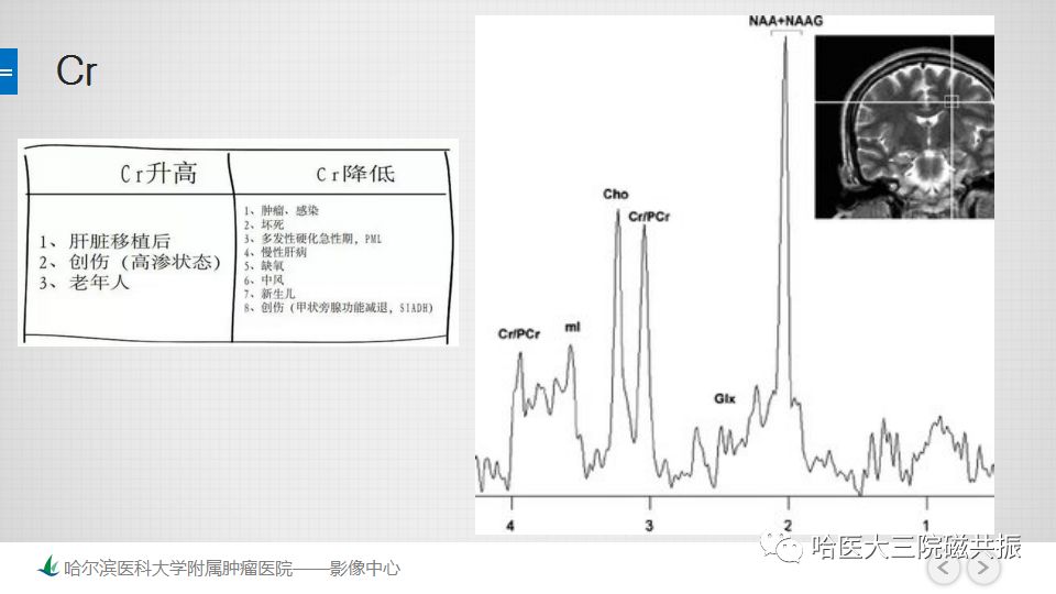影像PPT - 【PPT】磁共振波谱（MRS）的那些事-25
