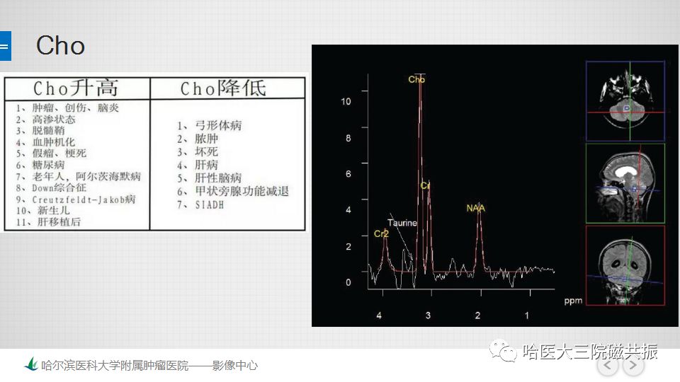 影像PPT - 【PPT】磁共振波谱（MRS）的那些事-26