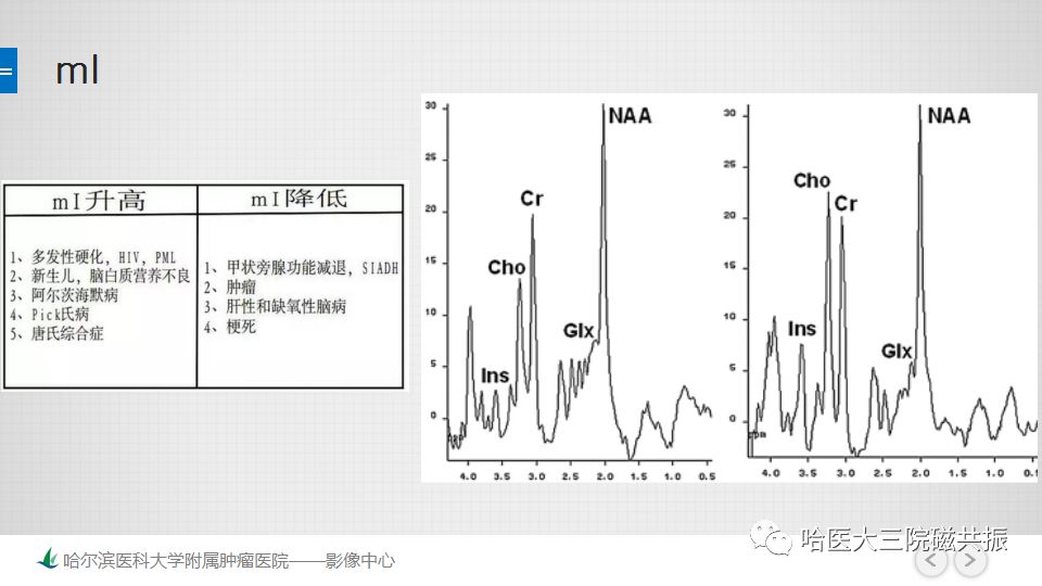 影像PPT - 【PPT】磁共振波谱（MRS）的那些事-27