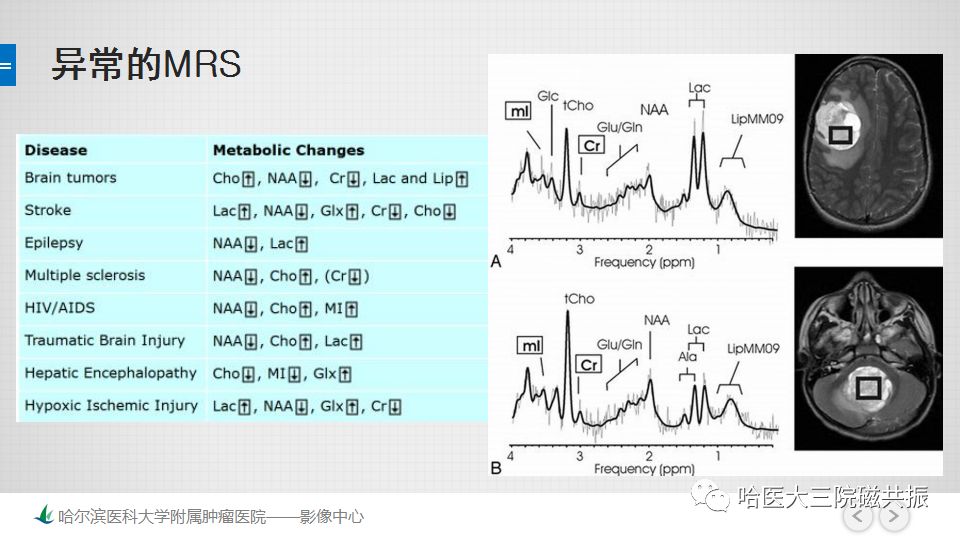 影像PPT - 【PPT】磁共振波谱（MRS）的那些事-28