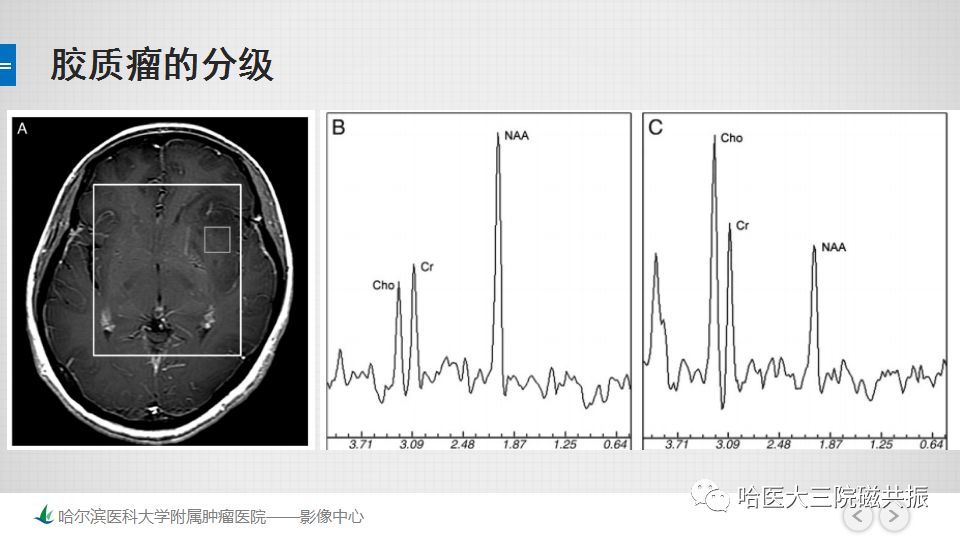 影像PPT - 【PPT】磁共振波谱（MRS）的那些事-37