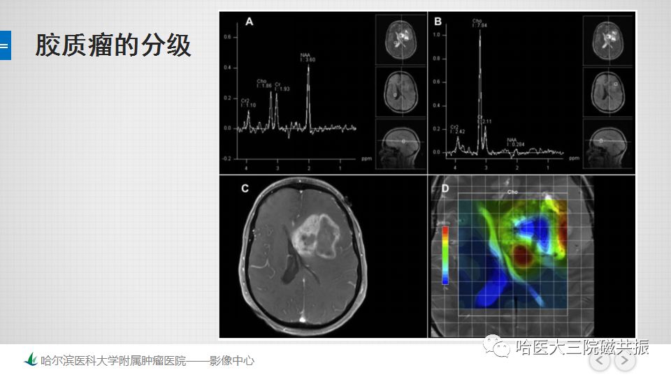 影像PPT - 【PPT】磁共振波谱（MRS）的那些事-38