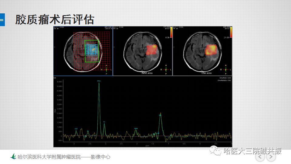 影像PPT - 【PPT】磁共振波谱（MRS）的那些事-41