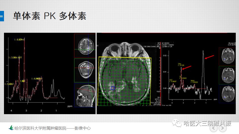 影像PPT - 【PPT】磁共振波谱（MRS）的那些事-44