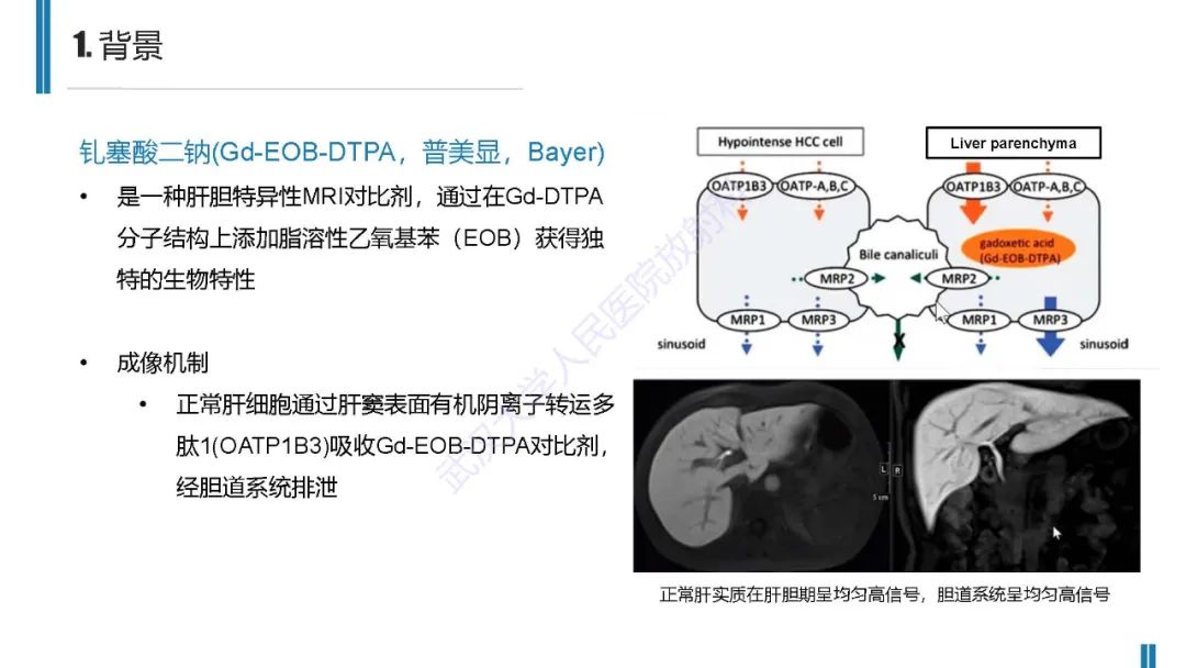 影像PPT - 【PPT】肝胆期肝局灶性异常信号影像诊断-4