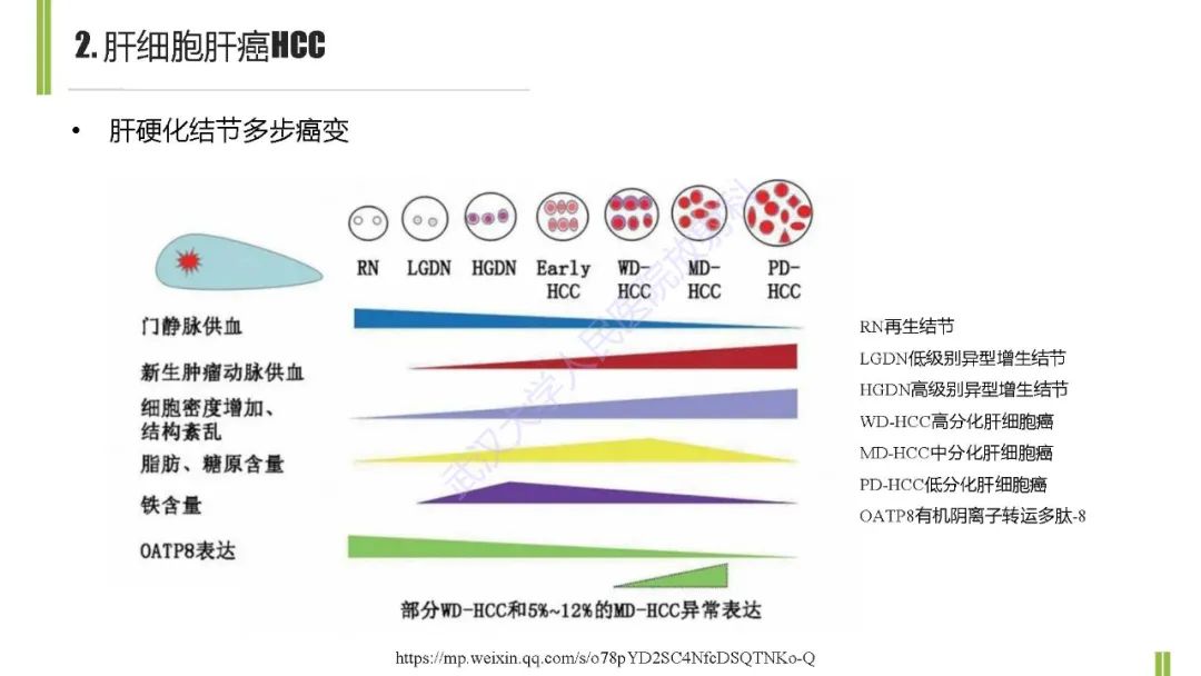 影像PPT - 【PPT】肝胆期肝局灶性异常信号影像诊断-6