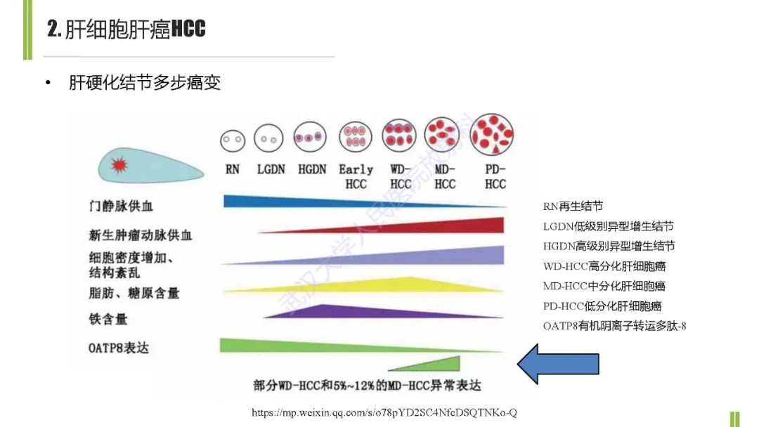 影像PPT - 【PPT】肝胆期肝局灶性异常信号影像诊断-12
