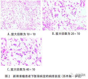 影像PPT - 【病例】颌骨副脊索瘤1例CT影像-2 影像PPT - 【病例】颌骨副脊索瘤1例CT影像-2