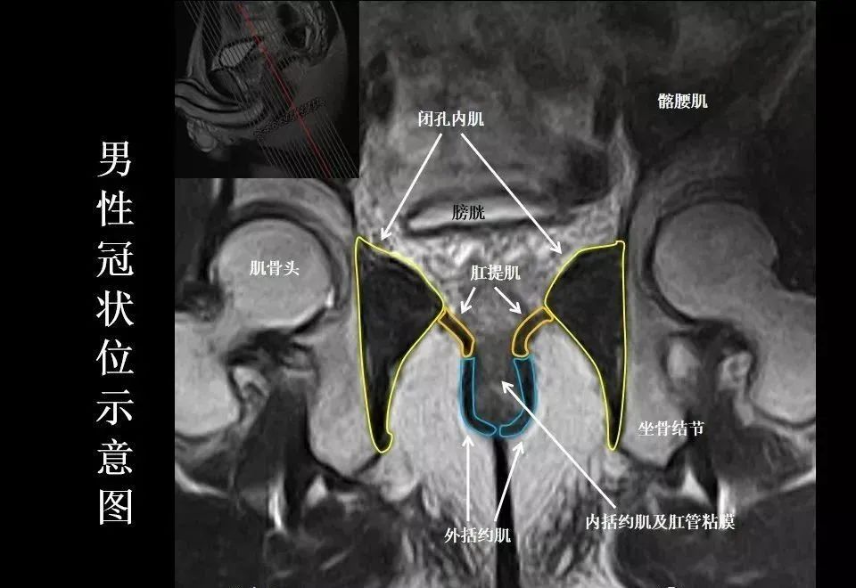 影像PPT - 8张图带你熟悉盆底MRI解剖-5