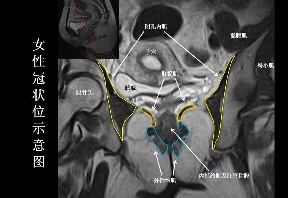 影像PPT - 8张图带你熟悉盆底MRI解剖-6
