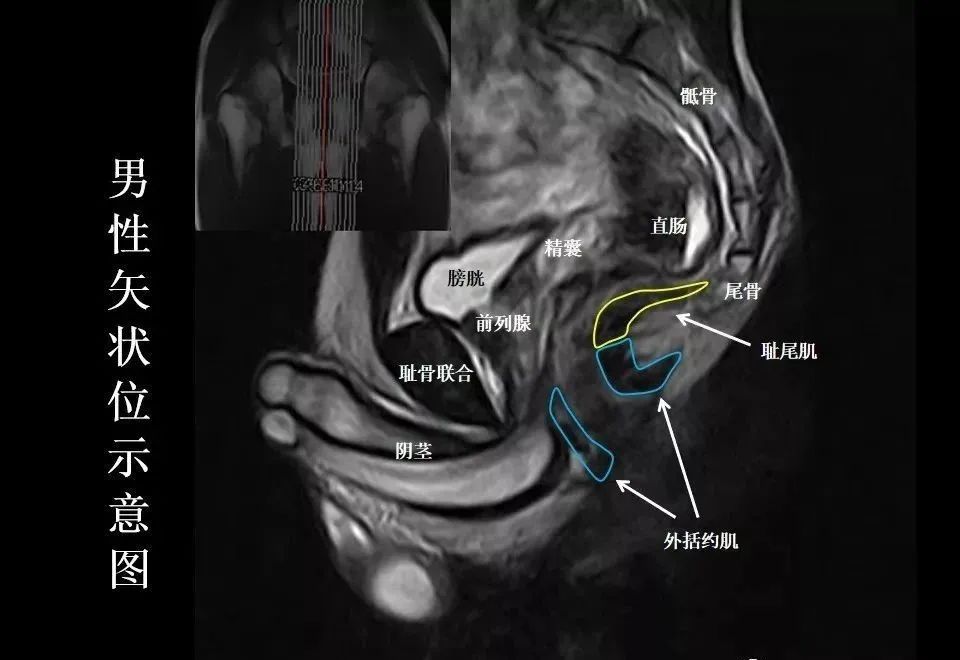 影像PPT - 8张图带你熟悉盆底MRI解剖-7