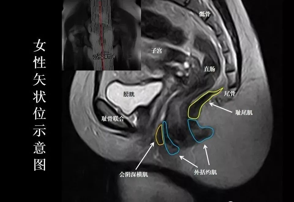 影像PPT - 8张图带你熟悉盆底MRI解剖-8