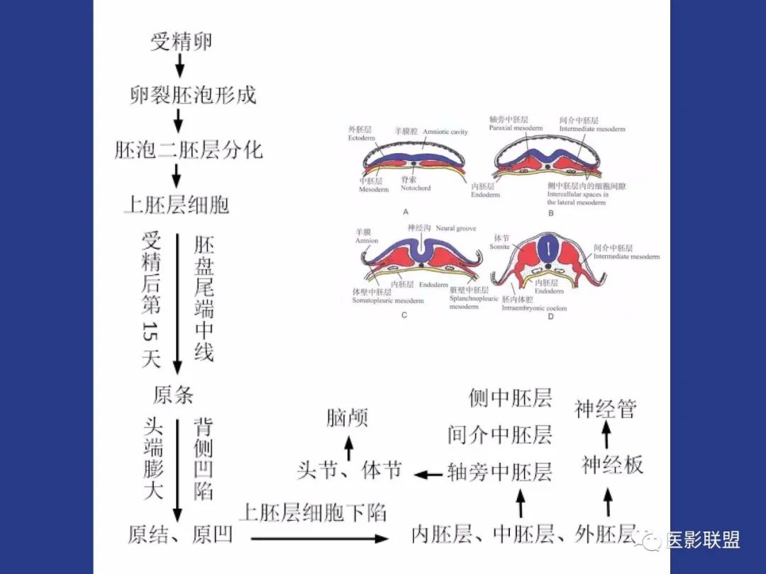 影像PPT - 【PPT】颅穹隆骨正常及常见变异的影像学表现-4